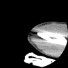 SPORK, NICO - 22.03.1976 - 02.08.2022 - CT obere Extremität - 17:51:17